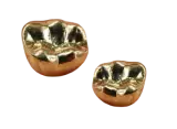 金歯